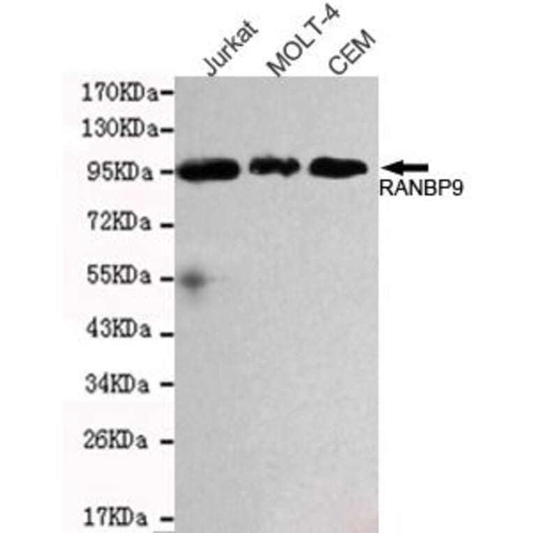 Anti-RanBP9 Antibody from Bioworld Technology (MB0163) - Antibodies.com