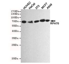 Anti-RPA1 Antibody from Bioworld Technology (MB0164) - Antibodies.com
