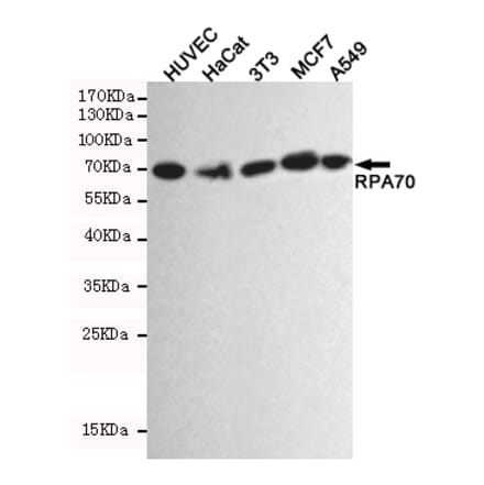 Anti-RPA1 Antibody from Bioworld Technology (MB0164) - Antibodies.com