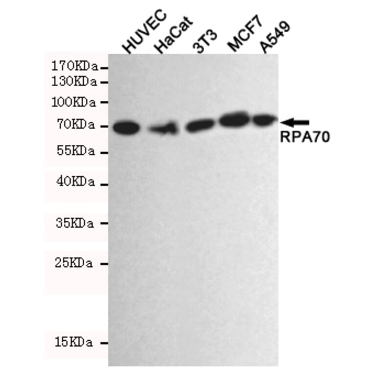 Anti-RPA1 Antibody from Bioworld Technology (MB0164) - Antibodies.com