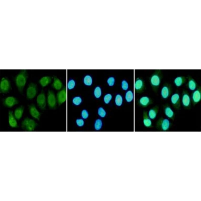 Anti-RPA1 Antibody from Bioworld Technology (MB0164) - Antibodies.com