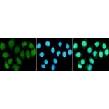 Anti-RPA1 Antibody from Bioworld Technology (MB0164) - Antibodies.com