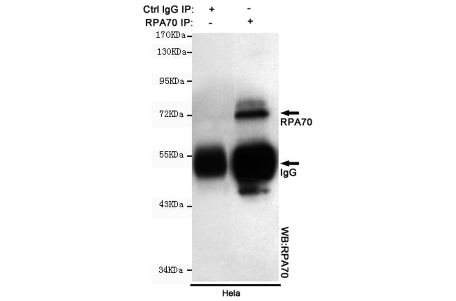Anti-RPA1 Antibody from Bioworld Technology (MB0164) - Antibodies.com
