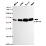Anti-Smad2 Antibody from Bioworld Technology (MB0165) - Antibodies.com