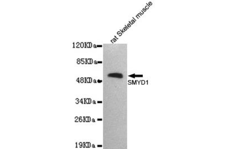 Anti-SMYD1 Antibody from Bioworld Technology (MB0166) - Antibodies.com