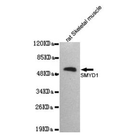 Anti-SMYD1 Antibody from Bioworld Technology (MB0166) - Antibodies.com