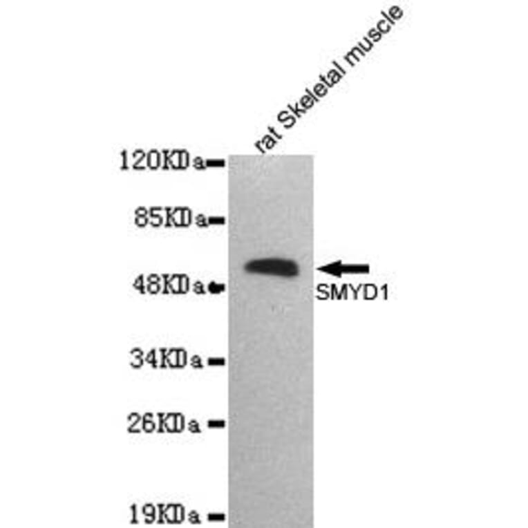 Anti-SMYD1 Antibody from Bioworld Technology (MB0166) - Antibodies.com