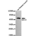 Anti-SMYD1 Antibody from Bioworld Technology (MB0166) - Antibodies.com