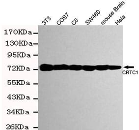 Anti-TORC1 ( IgM) Antibody from Bioworld Technology (MB0169) - Antibodies.com