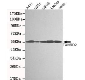 Anti-TXNRD2 Antibody from Bioworld Technology (MB0170) - Antibodies.com