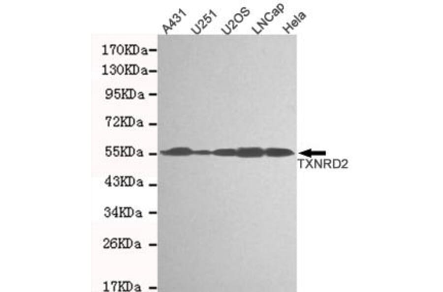 Anti-TXNRD2 Antibody from Bioworld Technology (MB0170) - Antibodies.com