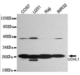 Anti-UCHL1 Antibody from Bioworld Technology (MB0171) - Antibodies.com