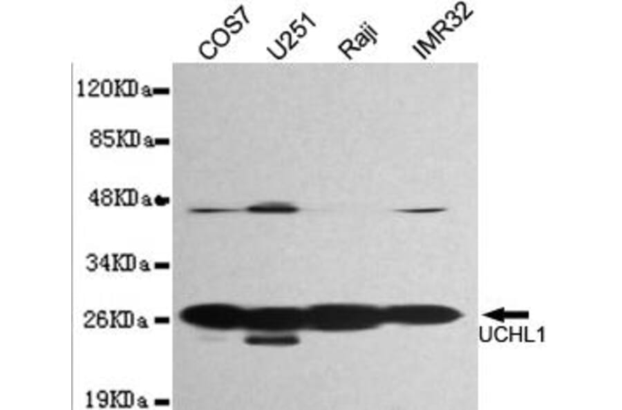 Anti-UCHL1 Antibody from Bioworld Technology (MB0171) - Antibodies.com