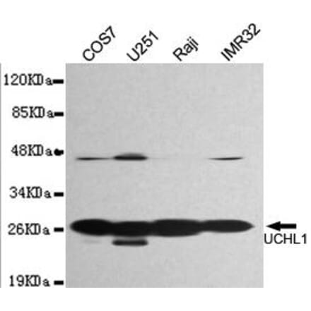 Anti-UCHL1 Antibody from Bioworld Technology (MB0171) - Antibodies.com