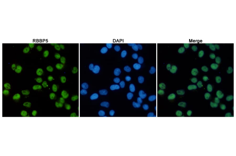 Anti-RBBP5 (1C9) Antibody from Bioworld Technology (MB0173) - Antibodies.com