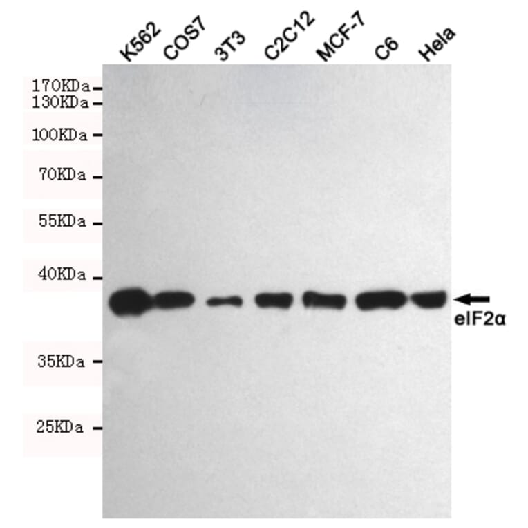 Anti-eIF2α (2E4) Antibody from Bioworld Technology (MB0174) - Antibodies.com