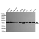 Anti-FEN1 (7H8) Antibody from Bioworld Technology (MB0179) - Antibodies.com