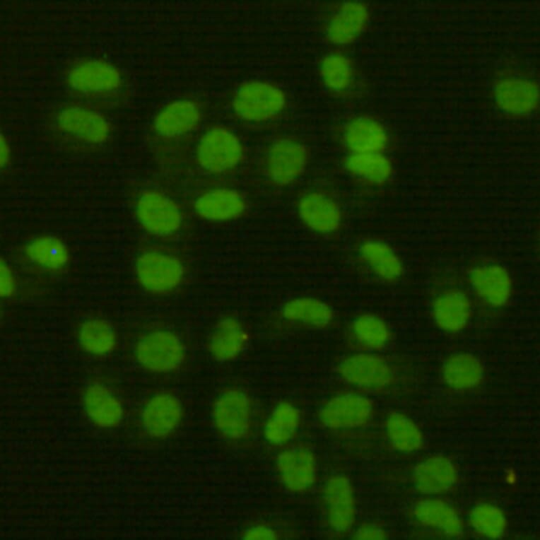 Anti-FEN1 (7H8) Antibody from Bioworld Technology (MB0179) - Antibodies.com