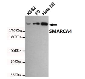 Anti-SMARCA4 (6D7) Antibody from Bioworld Technology (MB0180) - Antibodies.com