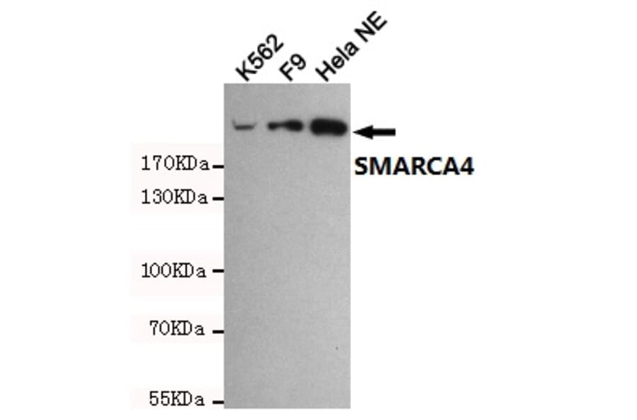 Anti-SMARCA4 (6D7) Antibody from Bioworld Technology (MB0180) - Antibodies.com