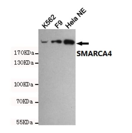 Anti-SMARCA4 (6D7) Antibody from Bioworld Technology (MB0180) - Antibodies.com