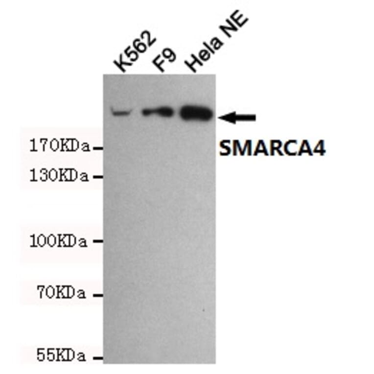 Anti-SMARCA4 (6D7) Antibody from Bioworld Technology (MB0180) - Antibodies.com