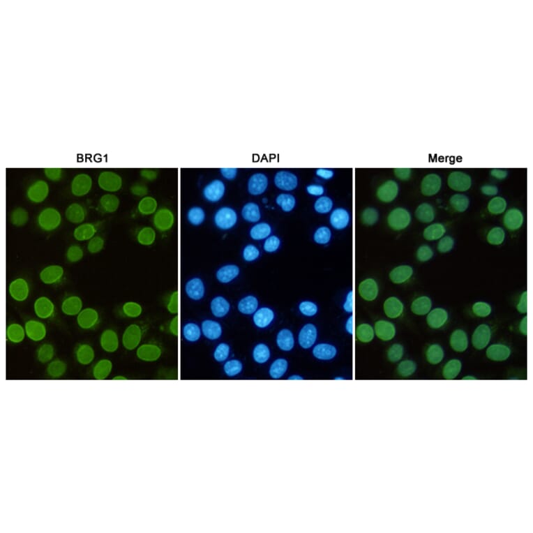 Anti-SMARCA4 (6D7) Antibody from Bioworld Technology (MB0180) - Antibodies.com