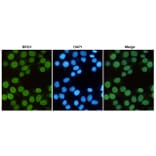 Anti-SMARCA4 (6D7) Antibody from Bioworld Technology (MB0180) - Antibodies.com