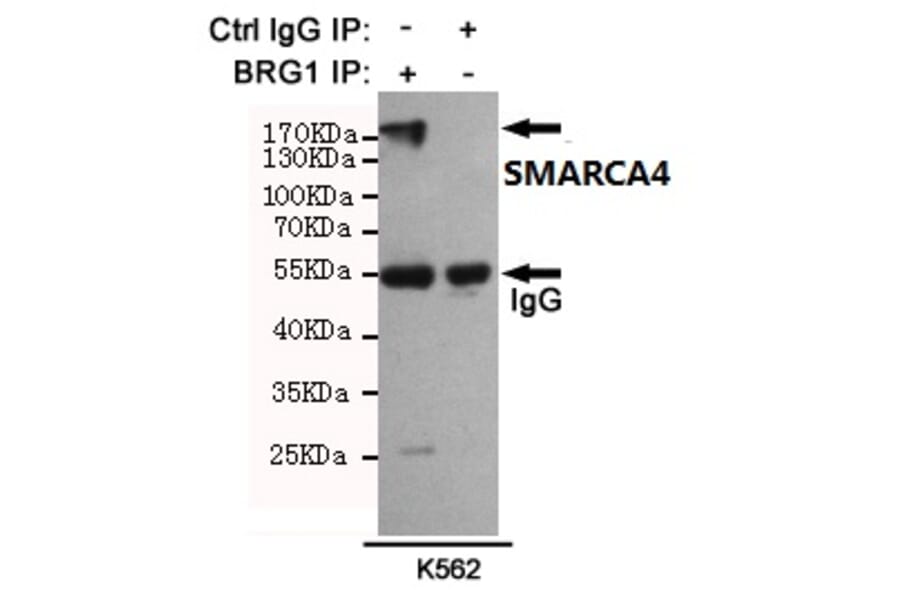 Anti-SMARCA4 (6D7) Antibody from Bioworld Technology (MB0180) - Antibodies.com