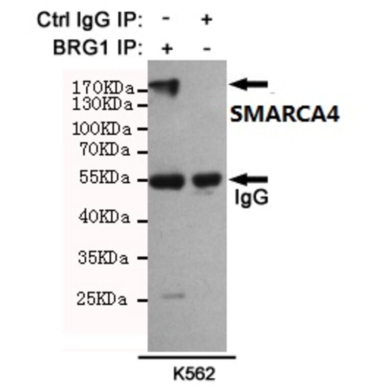 Anti-SMARCA4 (6D7) Antibody from Bioworld Technology (MB0180) - Antibodies.com