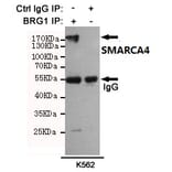 Anti-SMARCA4 (6D7) Antibody from Bioworld Technology (MB0180) - Antibodies.com