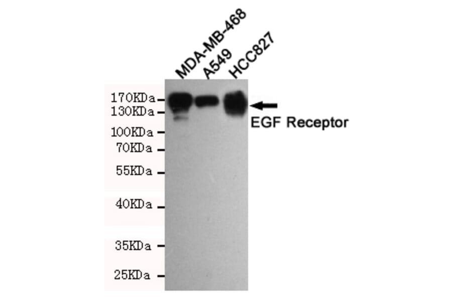 Anti-EGFR (3F12) Antibody from Bioworld Technology (MB0182) - Antibodies.com