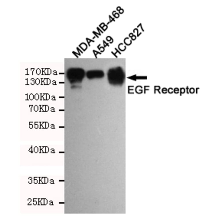 Anti-EGFR (3F12) Antibody from Bioworld Technology (MB0182) - Antibodies.com