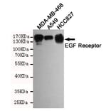 Anti-EGFR (3F12) Antibody from Bioworld Technology (MB0182) - Antibodies.com