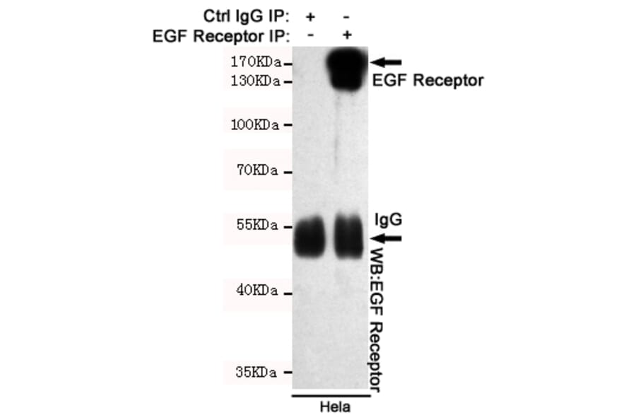Anti-EGFR (3F12) Antibody from Bioworld Technology (MB0182) - Antibodies.com