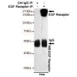 Anti-EGFR (3F12) Antibody from Bioworld Technology (MB0182) - Antibodies.com