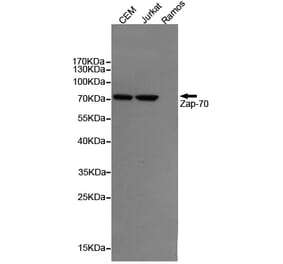 Anti-ZAP70 (4B2) Antibody from Bioworld Technology (MB0187) - Antibodies.com