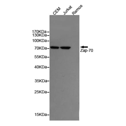 Anti-ZAP70 (4B2) Antibody from Bioworld Technology (MB0187) - Antibodies.com