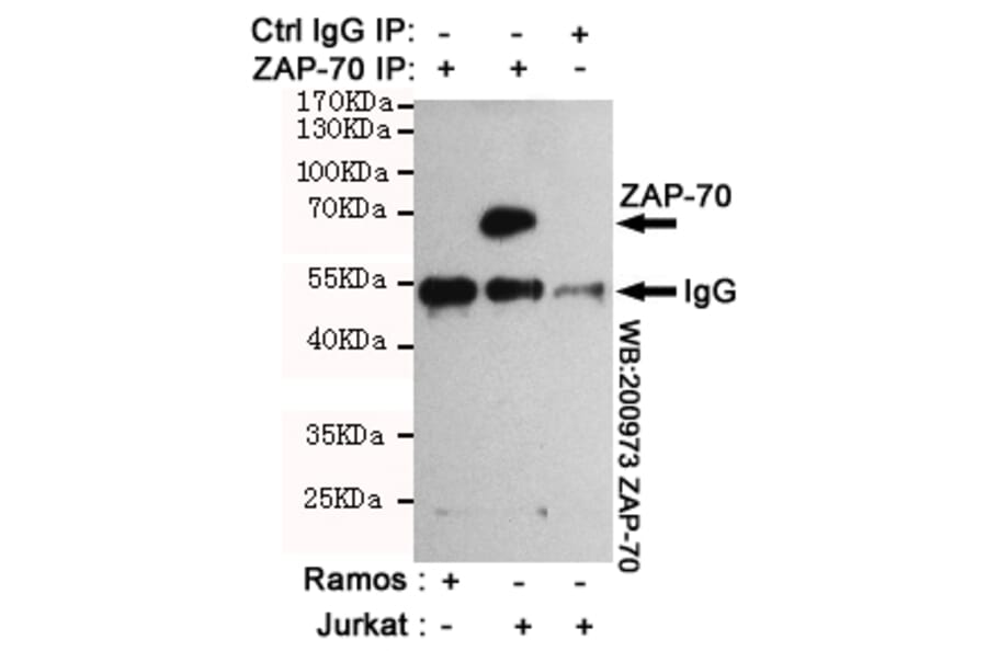 Anti-ZAP70 (4B2) Antibody from Bioworld Technology (MB0187) - Antibodies.com