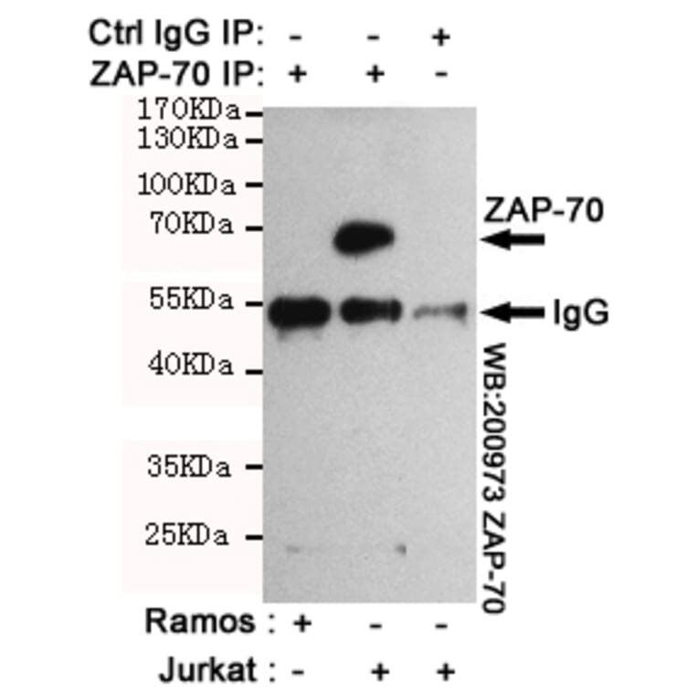 Anti-ZAP70 (4B2) Antibody from Bioworld Technology (MB0187) - Antibodies.com