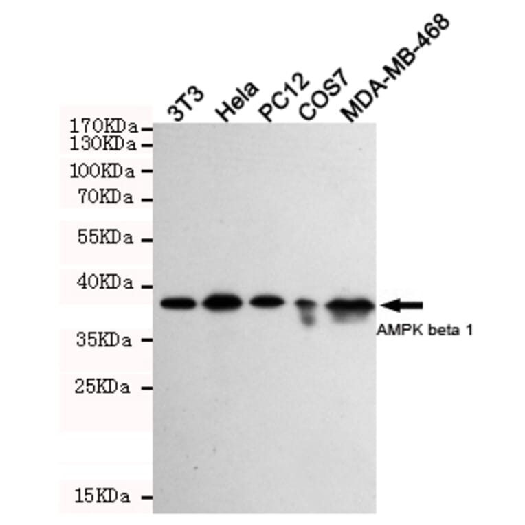 Anti-AMPKβ1 (1A7) Antibody from Bioworld Technology (MB0188) - Antibodies.com