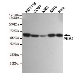 Anti-PKM2 (1F2) Antibody from Bioworld Technology (MB0189) - Antibodies.com