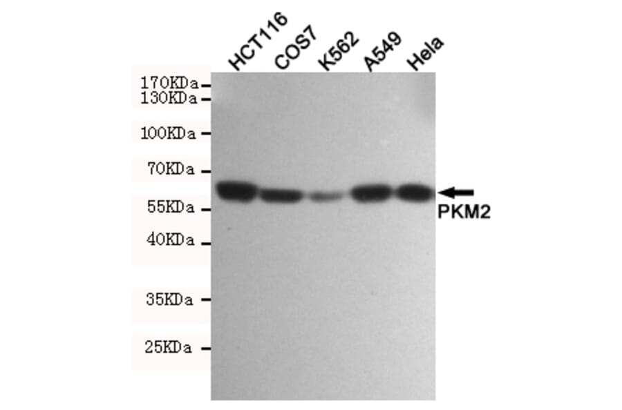 Anti-PKM2 (1F2) Antibody from Bioworld Technology (MB0189) - Antibodies.com