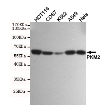 Anti-PKM2 (1F2) Antibody from Bioworld Technology (MB0189) - Antibodies.com