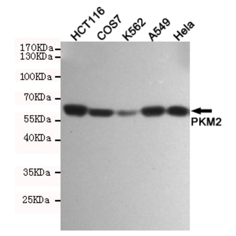 Anti-PKM2 (1F2) Antibody from Bioworld Technology (MB0189) - Antibodies.com