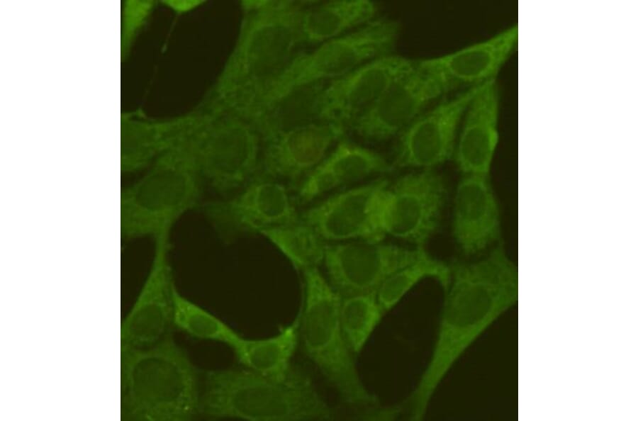 Anti-PKM2 (1F2) Antibody from Bioworld Technology (MB0189) - Antibodies.com