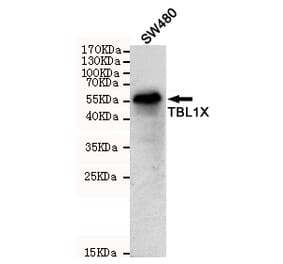 Anti-TBL1 (4H2) Antibody from Bioworld Technology (MB0192) - Antibodies.com