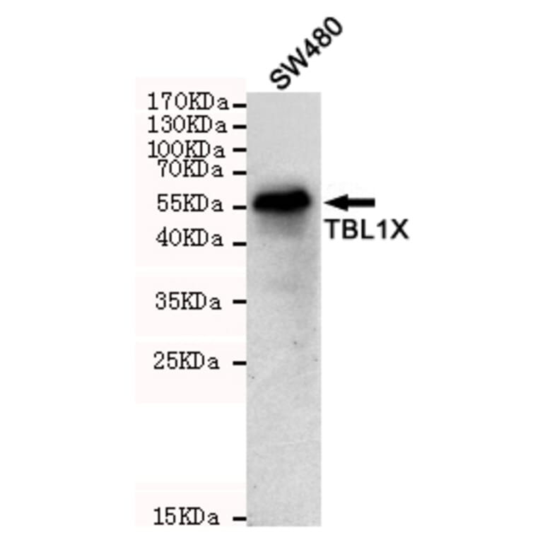 Anti-TBL1 (4H2) Antibody from Bioworld Technology (MB0192) - Antibodies.com