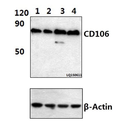 Anti-CD106/VCAM1 (2C11) Antibody from Bioworld Technology (MB8559) - Antibodies.com