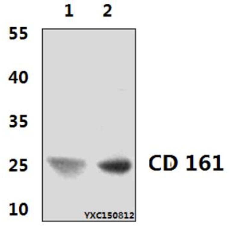 Anti-CD161 (3F8) Antibody from Bioworld Technology (MB8565) - Antibodies.com